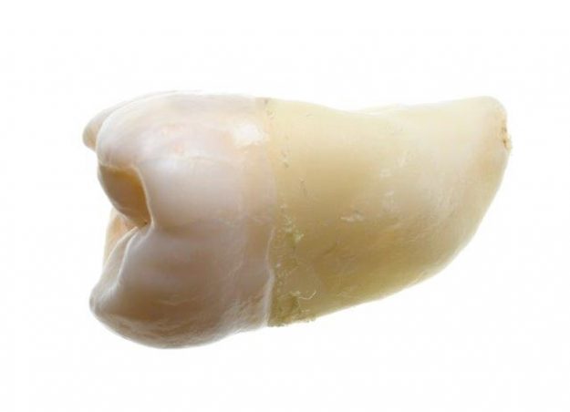 removed-tooth Tooth Gets Knocked Out