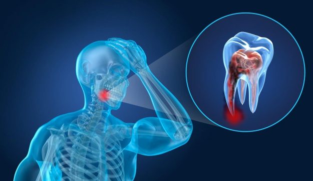 tooth-pain-after-tooth-accident Tooth pain after tooth accident